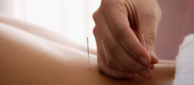 Align Acupuncture